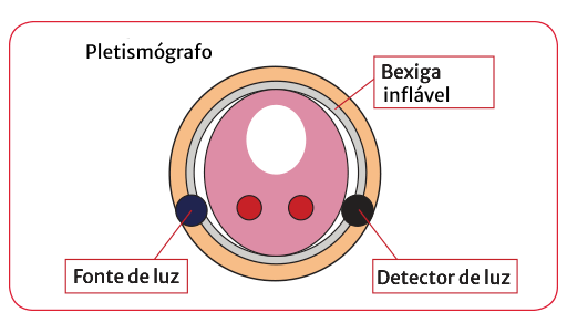 M&eacute;todo de fixa&ccedil;&atilde;o de volume